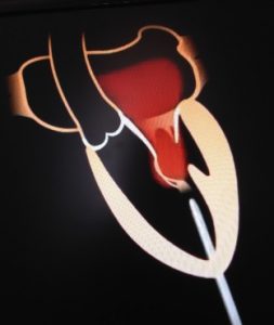 NOVIT&Agrave;! Piccolo Orecchino A Forma Di Cuore Con Cartilagine E Parte Posteriore Piatta, Orecchino Al Trago