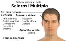 Sclerosi Multipla: trattamento dei sintomi con angioplastica venosa sclerosi multipla schema