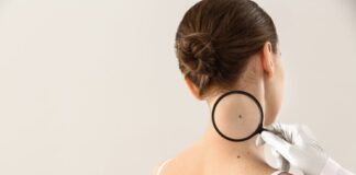 Nei, prevenzione dermatologica: la campagna di Heliocare nei donna